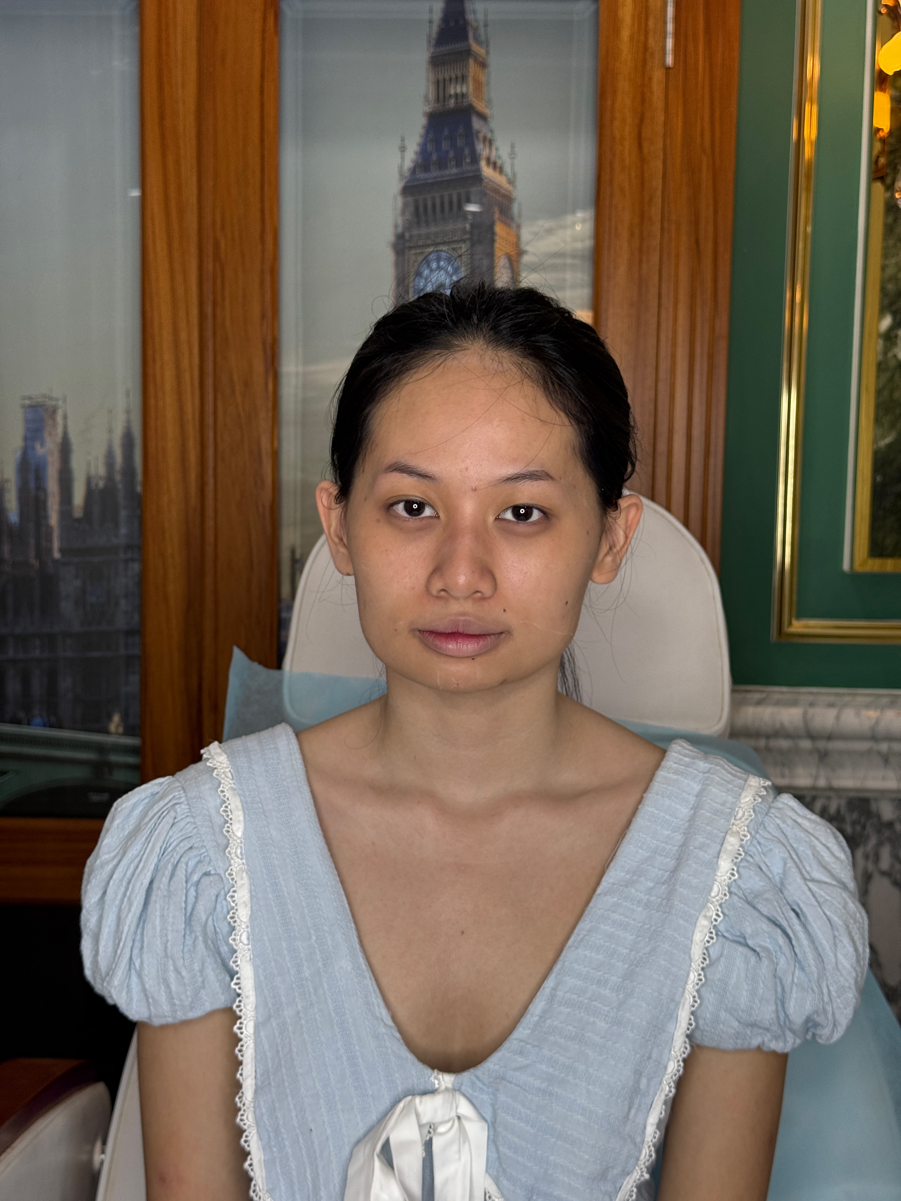 Trước